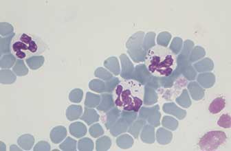 Anaplasmosis causada por Anaplasma phagocytophilum
