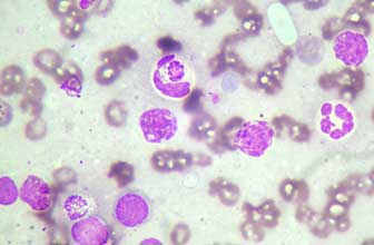 Erliquiosis causada por Ehrlichia canis