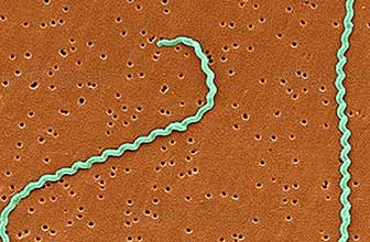 Leptospirosis causada por Leptospira interrogans