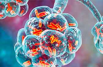 Mycoplasma pneumoniae infection