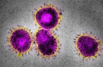 Severe acute respiratory syndrome (SARS-2003) caused by SARS-CoV