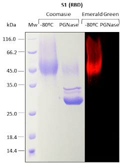 N-Glicosilación