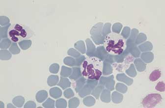 Anaplasma phagocytophilum